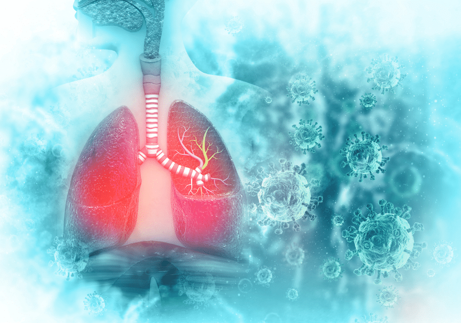 Lung Cancer_ treatment in Ayurveda Arogyavedh Ayurveda and Dr. Banashree Patil Baner Balewadi