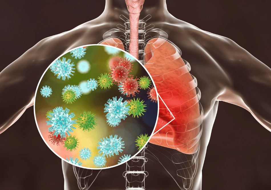 Lung Disease and Asthma Treatment in Ayurveda Pneumonia treatment in Ayurveda