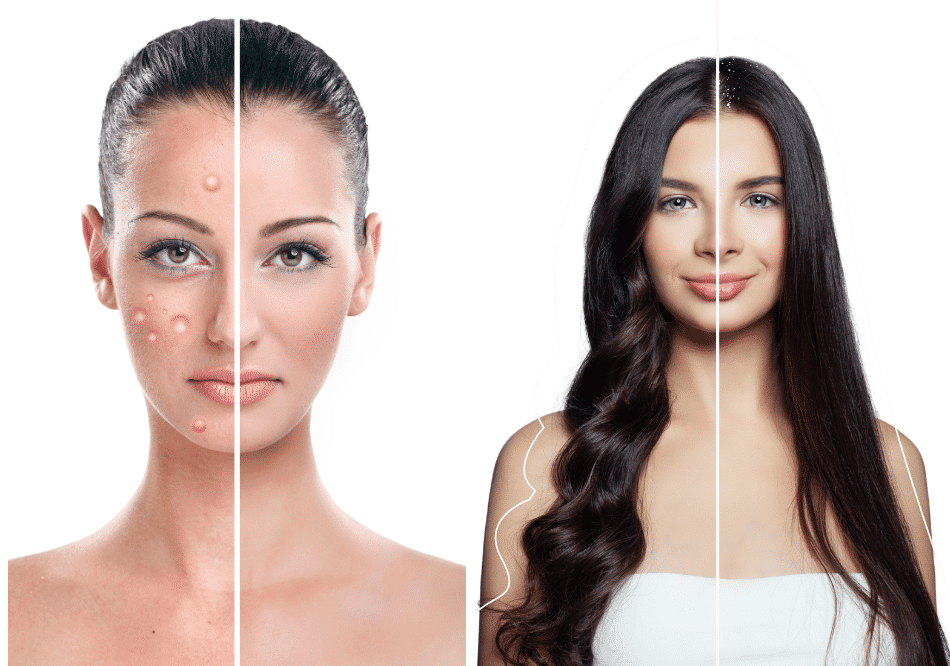 Skin Disease, Hair, and Beauty Treatment in Ayurveda – Baner Balewadi
