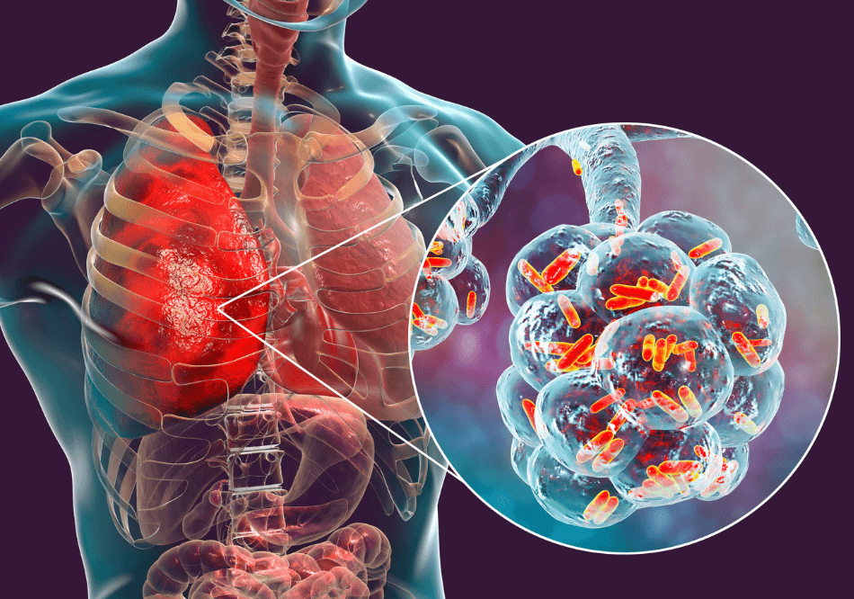 ayurvedic treatment for Lung Disease arogyavedh ayurveda Near Baner Balewadi