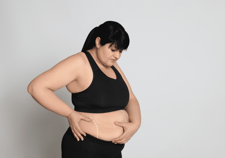 obesity treatment in ayurveda | Arogyavedh Ayurveda | Dr. Banashree Patil Baner Balewadi