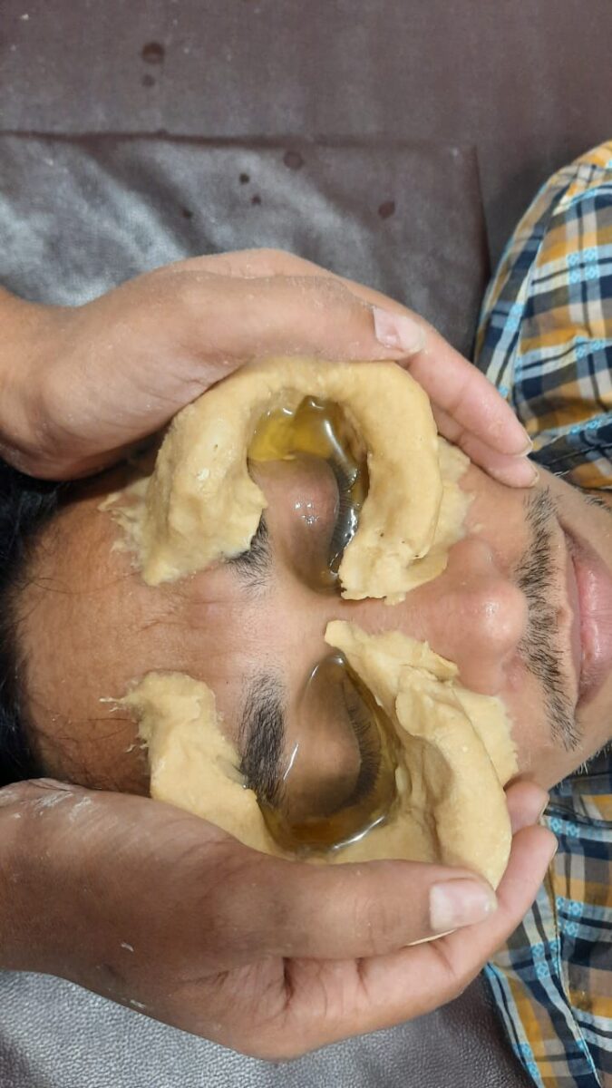 नेत्र तर्पण treatment clinic baner