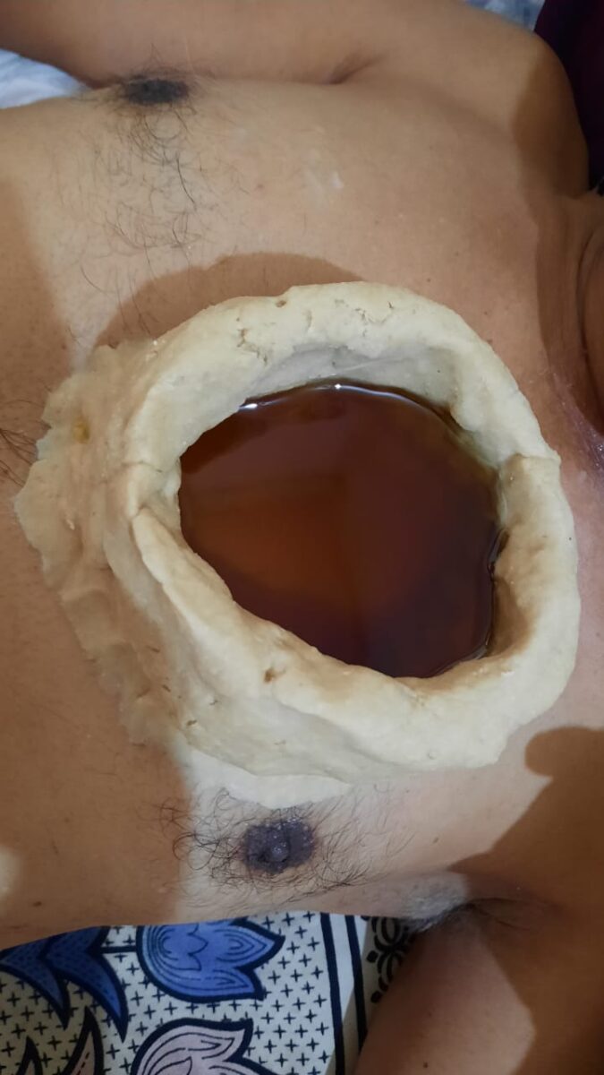 हृदय बस्ती treatment in ayurveda baner balewadi